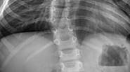 La columna vertebral es una parte muy importante de tu cuerpo… ahora tienes la oportunidad de cuidar de la columna vertebral de las personas como cirujano profesional en […]